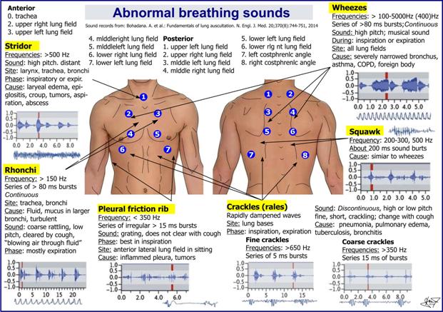 Annhill Dream What Lungs Will Sound Telegraph